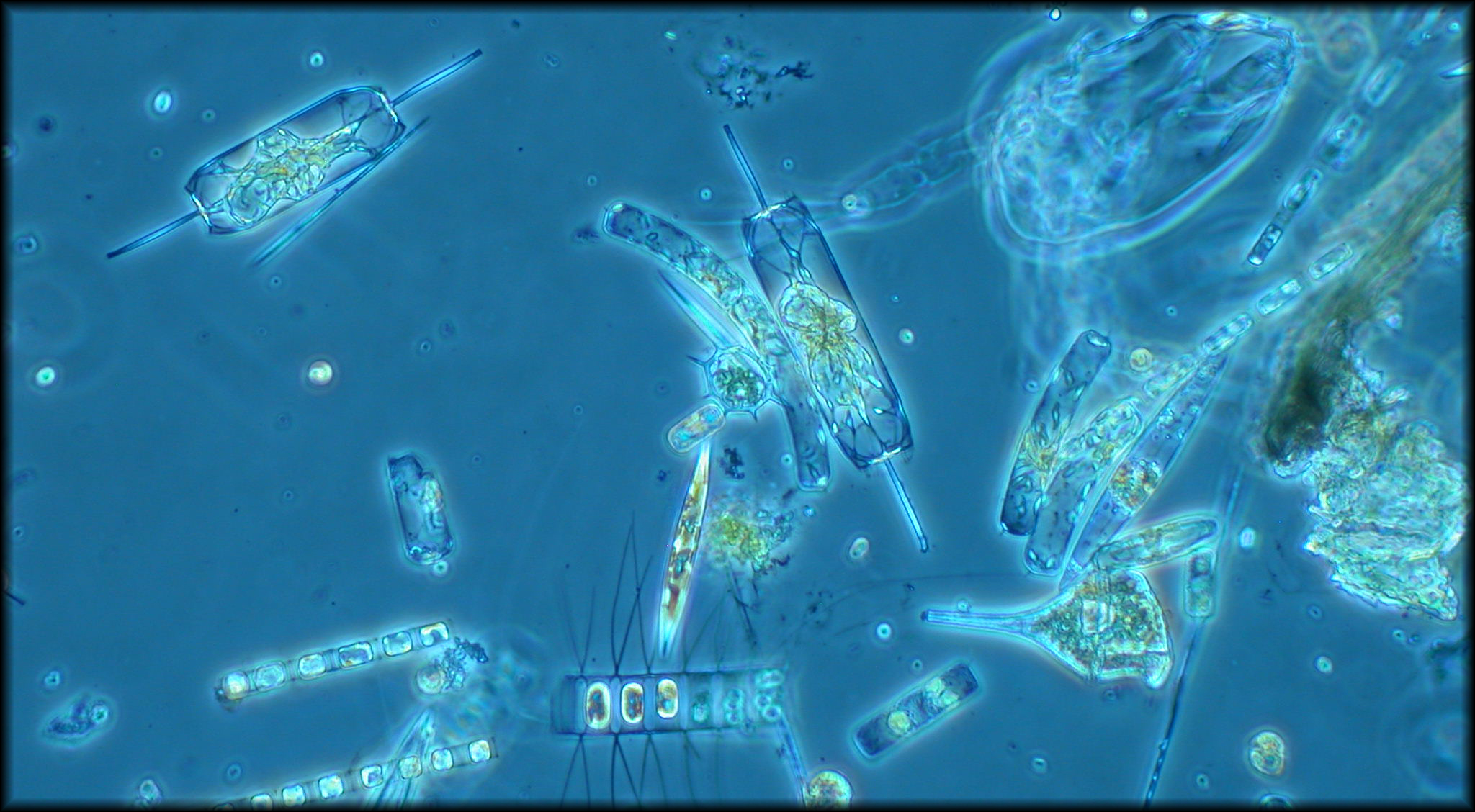 Фитопланктон образован. Фитопланктон мирового океана. Фитопланктон водоросли. Фитопланктон под микроскопом. Фитопланктон фотосинтез.